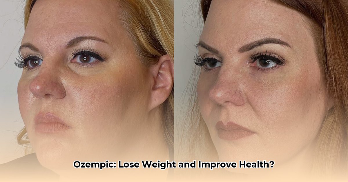 does iehp cover ozempic for weight loss